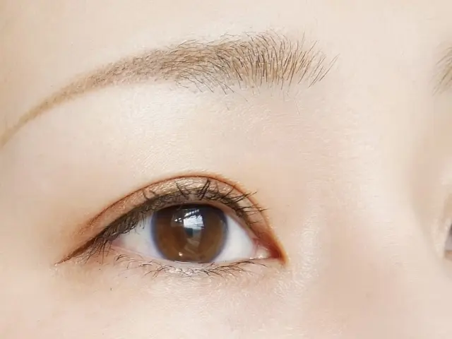 【調査済】二重整形のダウンタイムを解説!施術の種類とダウンタイム